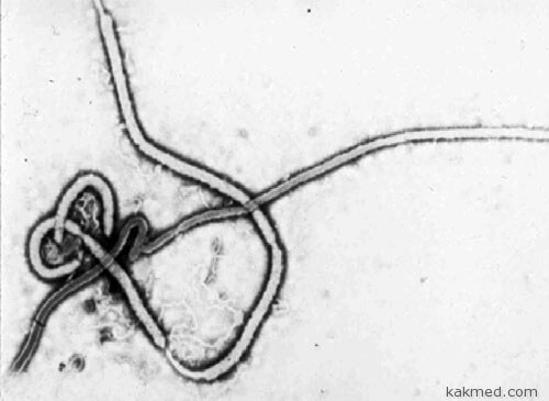 Победа над вирусом Эбола