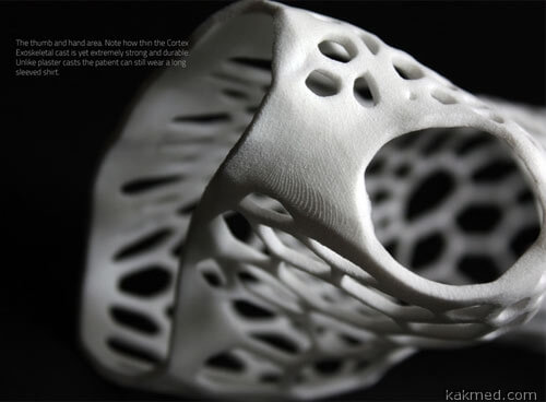 Ортопедическая повязка на 3D-принтере