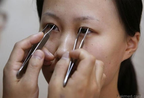 Триумф косметической хирургии в Китае