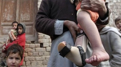 Вспышка полиомиелита в Пакистане