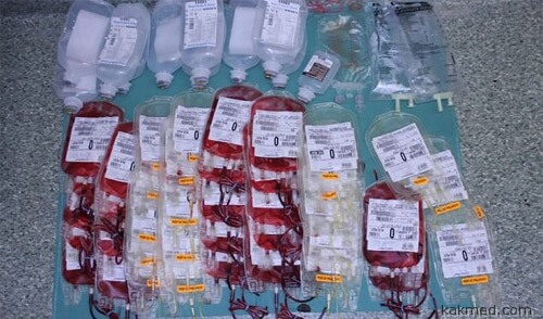 20 переливаний крови
