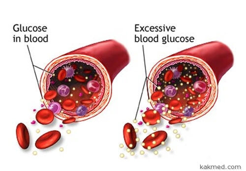 Глюкоза в крови