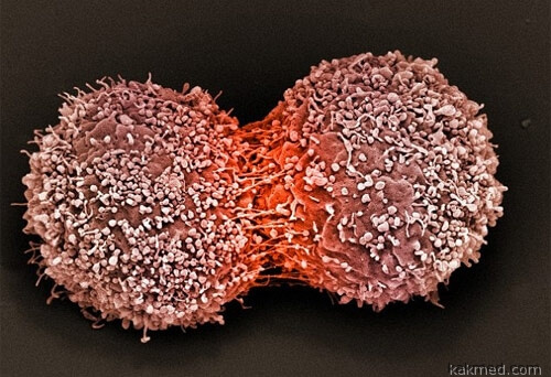 Размножение раковых клеток ночью
