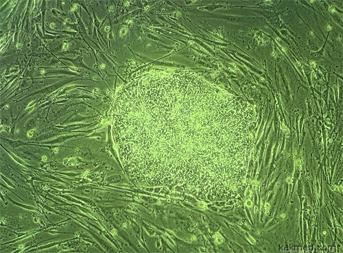 Человеческая эмбриональная стволовая клетка