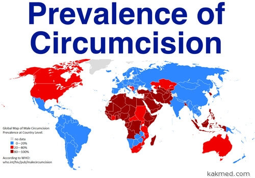 Карта обрезания