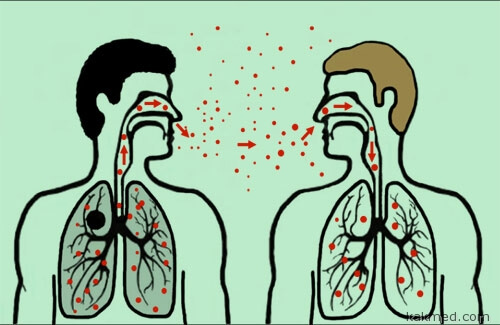 Как заразиться туберкулезом