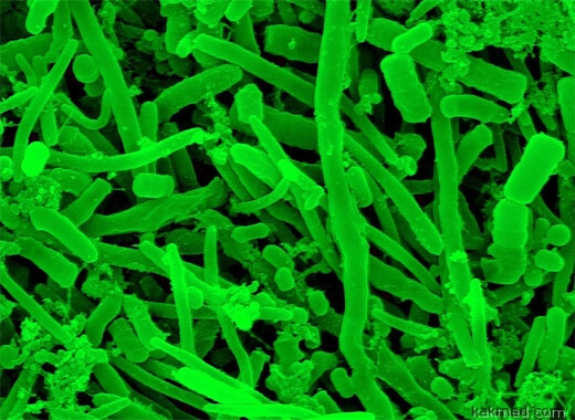зубной налет бактерии
