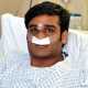 Студенту из Пакистана на свадьбе выстрелили в бровь. Пулю врачи извлекли через нос