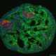 Биоинженеры создали новый тип стволовых клеток, которые не способны перерождаться в опухоли