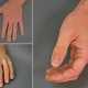 Протезы пальцев, которые не отличишь от живых, разработали дизайнеры из Германии