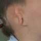 Новые уши из рёбер изготовили и пересадили 9-летнему мальчику в Лондоне